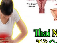 Tiếp nhận xử lý kịp thời trường hợp mang thai ngoài tử cung nguy hiểm đến tính mạng