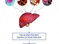 Xơ gan - con đường tiềm ẩn của ung thư gan.