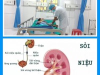 Cảnh báo bệnh nhân sốc nhiễm khuẩn, suy đa tạng do sỏi thận