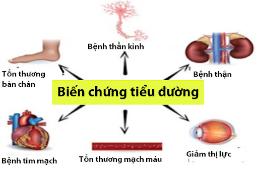 Hình ảnh minh họa