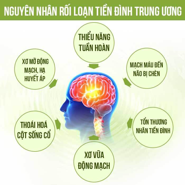 Bệnh rối loạn tiền đình và những điều cần biết