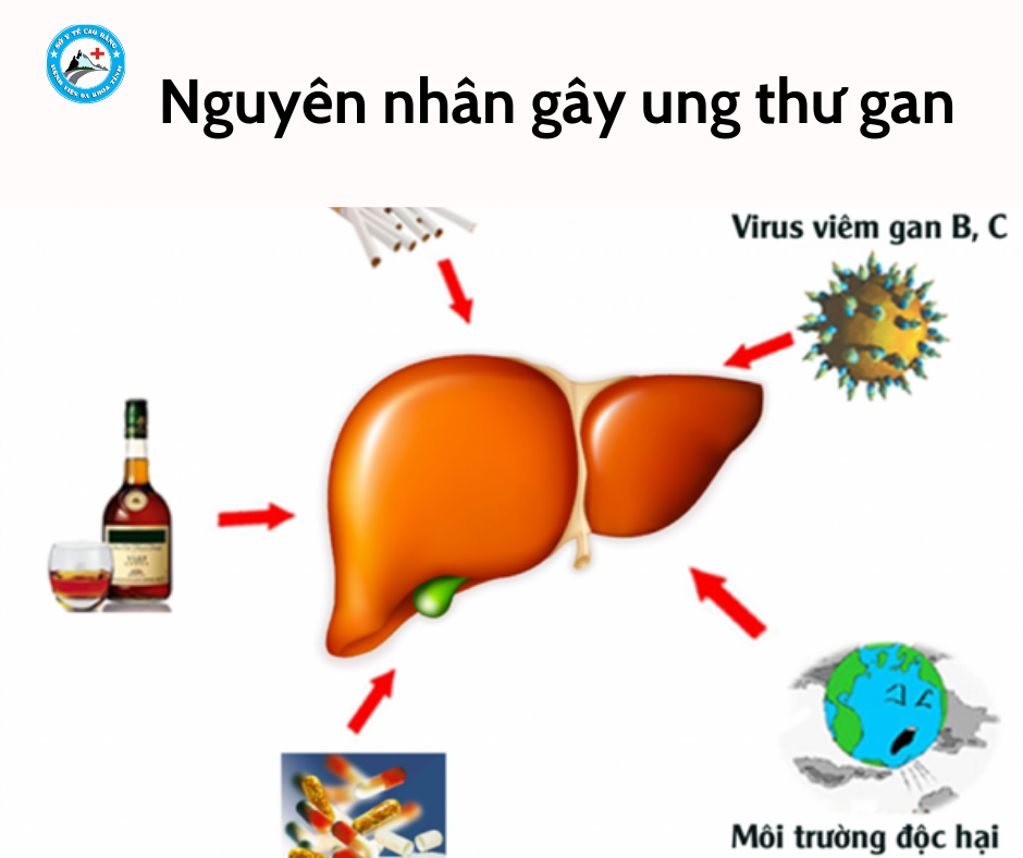 Thêm tiêu đề phụ